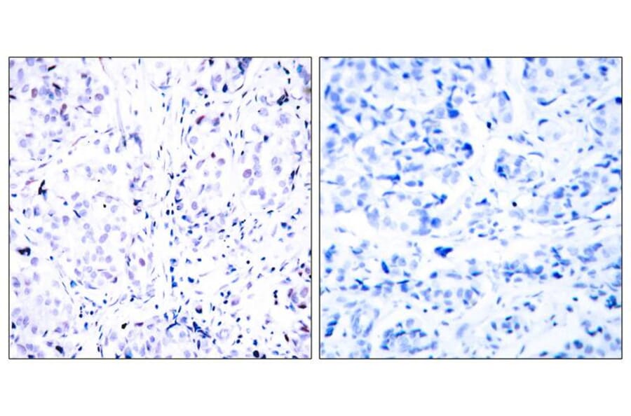 Immunohistochemistry - Rb (Ab-807) Antibody from Signalway Antibody (21109) - Antibodies.com