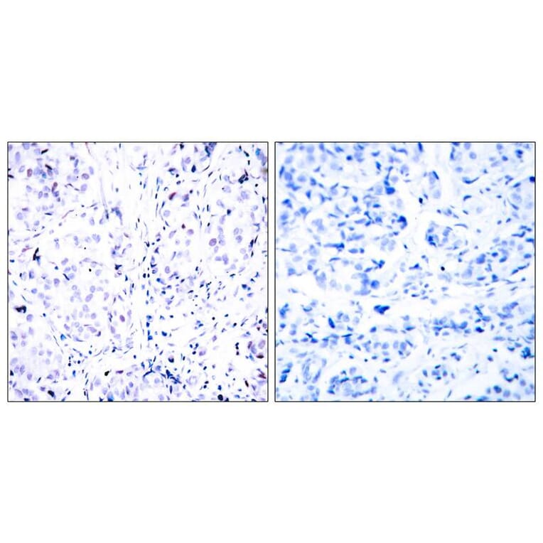 Immunohistochemistry - Rb (Ab-807) Antibody from Signalway Antibody (21109) - Antibodies.com