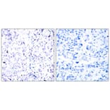 Immunohistochemistry - Rb (Ab-807) Antibody from Signalway Antibody (21109) - Antibodies.com
