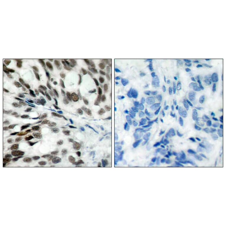 Immunohistochemistry - Rb (Ab-780) Antibody from Signalway Antibody (21110) - Antibodies.com