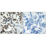 Immunohistochemistry - Rb (Ab-780) Antibody from Signalway Antibody (21110) - Antibodies.com
