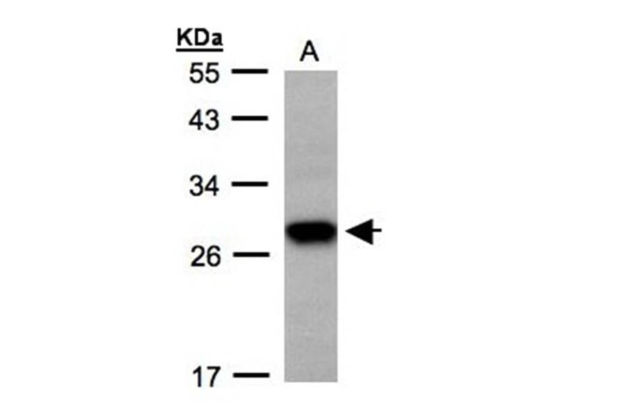 Tetraspan 1 antibody from Signalway Antibody (22048) - Antibodies.com