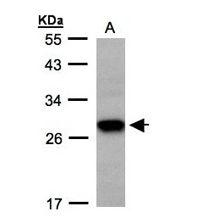 Tetraspan 1 antibody from Signalway Antibody (22048) - Antibodies.com
