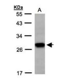 Tetraspan 1 antibody from Signalway Antibody (22048) - Antibodies.com