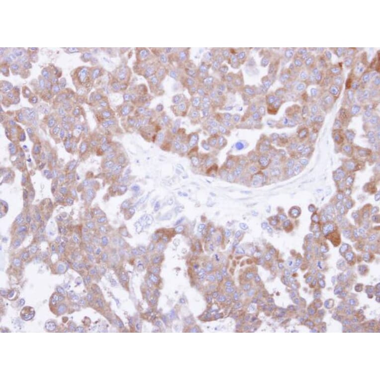 Immunohistochemistry - TCP-1 theta antibody from Signalway Antibody (22412) - Antibodies.com