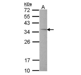 Rhodanese antibody from Signalway Antibody (22550) - Antibodies.com