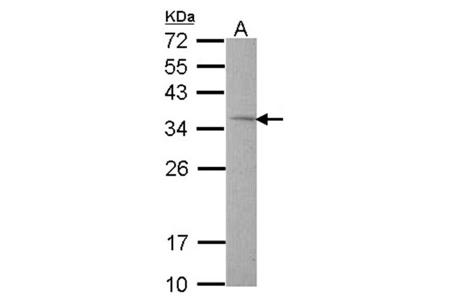 Rhodanese antibody from Signalway Antibody (22550) - Antibodies.com