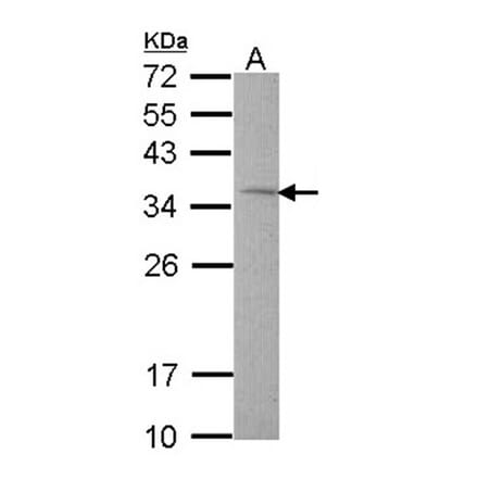 Rhodanese antibody from Signalway Antibody (22550) - Antibodies.com