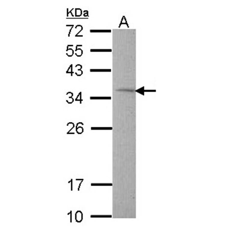 Rhodanese antibody from Signalway Antibody (22550) - Antibodies.com