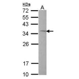 Rhodanese antibody from Signalway Antibody (22550) - Antibodies.com