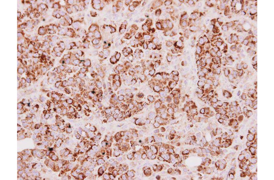 Immunohistochemistry - Rhodanese antibody from Signalway Antibody (22550) - Antibodies.com