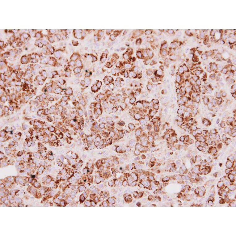 Immunohistochemistry - Rhodanese antibody from Signalway Antibody (22550) - Antibodies.com