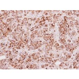 Immunohistochemistry - Rhodanese antibody from Signalway Antibody (22550) - Antibodies.com