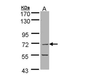 eIF2Bdelta antibody from Signalway Antibody (22566) - Antibodies.com
