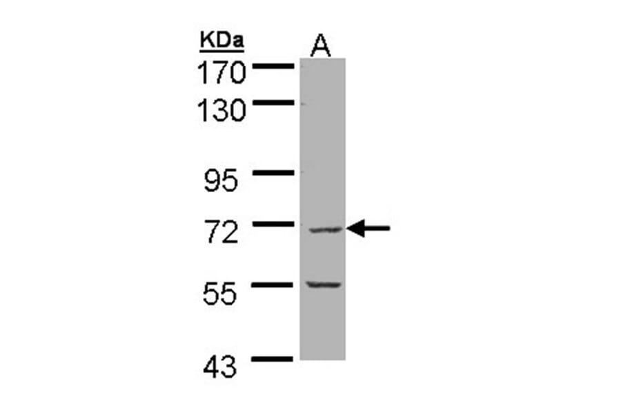 eIF2Bdelta antibody from Signalway Antibody (22566) - Antibodies.com