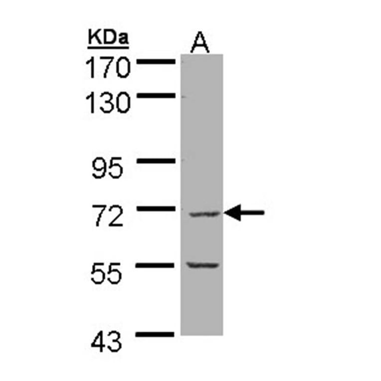 eIF2Bdelta antibody from Signalway Antibody (22566) - Antibodies.com