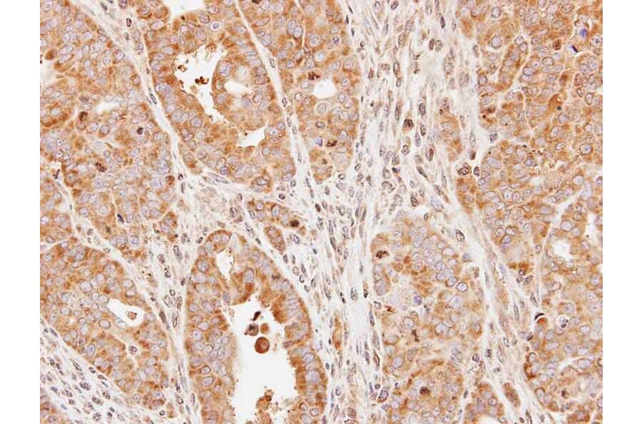Immunohistochemistry - eIF2Bdelta antibody from Signalway Antibody (22566) - Antibodies.com