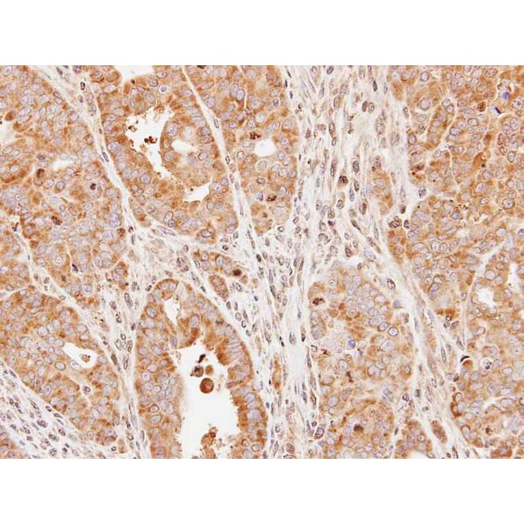 Immunohistochemistry - eIF2Bdelta antibody from Signalway Antibody (22566) - Antibodies.com