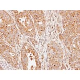 Immunohistochemistry - eIF2Bdelta antibody from Signalway Antibody (22566) - Antibodies.com