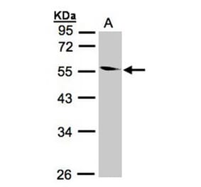 Coronin 1B antibody from Signalway Antibody (22682) - Antibodies.com