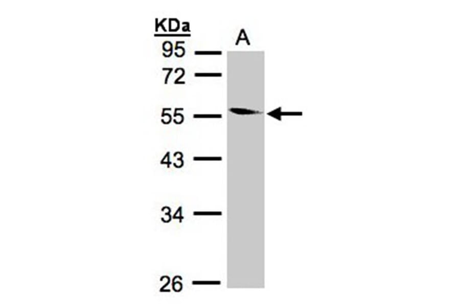 Coronin 1B antibody from Signalway Antibody (22682) - Antibodies.com
