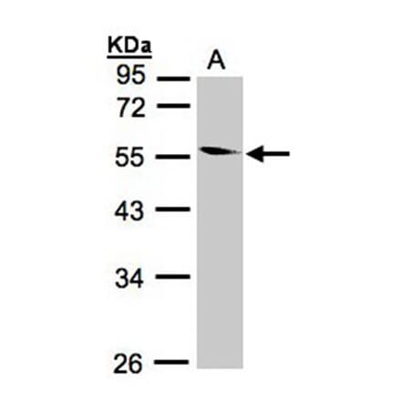 Coronin 1B antibody from Signalway Antibody (22682) - Antibodies.com