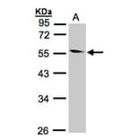 Coronin 1B antibody from Signalway Antibody (22682) - Antibodies.com