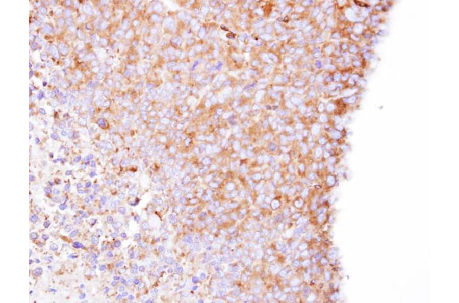 Immunohistochemistry - Coronin 1B antibody from Signalway Antibody (22682) - Antibodies.com