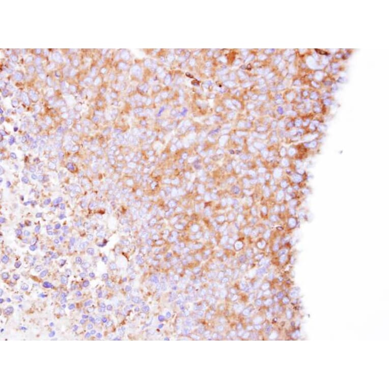 Immunohistochemistry - Coronin 1B antibody from Signalway Antibody (22682) - Antibodies.com