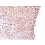 Immunohistochemistry - Coronin 1B antibody from Signalway Antibody (22682) - Antibodies.com