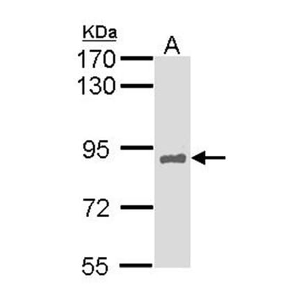 HNF-1 alpha antibody from Signalway Antibody (22684) - Antibodies.com
