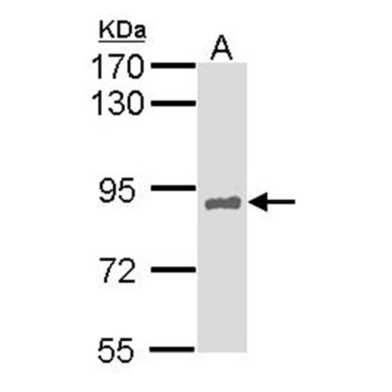 HNF-1 alpha antibody from Signalway Antibody (22684) - Antibodies.com
