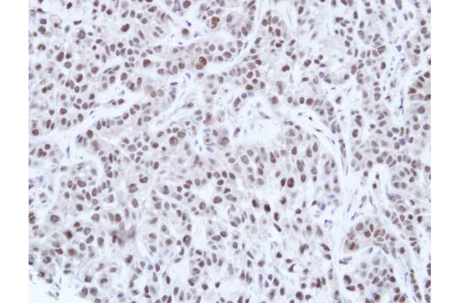 Immunohistochemistry - HNF-1 alpha antibody from Signalway Antibody (22684) - Antibodies.com