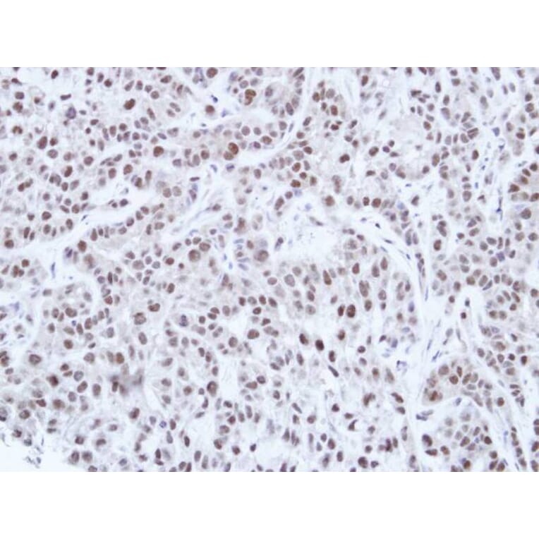 Immunohistochemistry - HNF-1 alpha antibody from Signalway Antibody (22684) - Antibodies.com