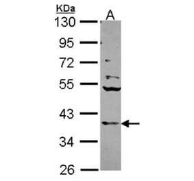 Cathepsin S antibody from Signalway Antibody (22690) - Antibodies.com