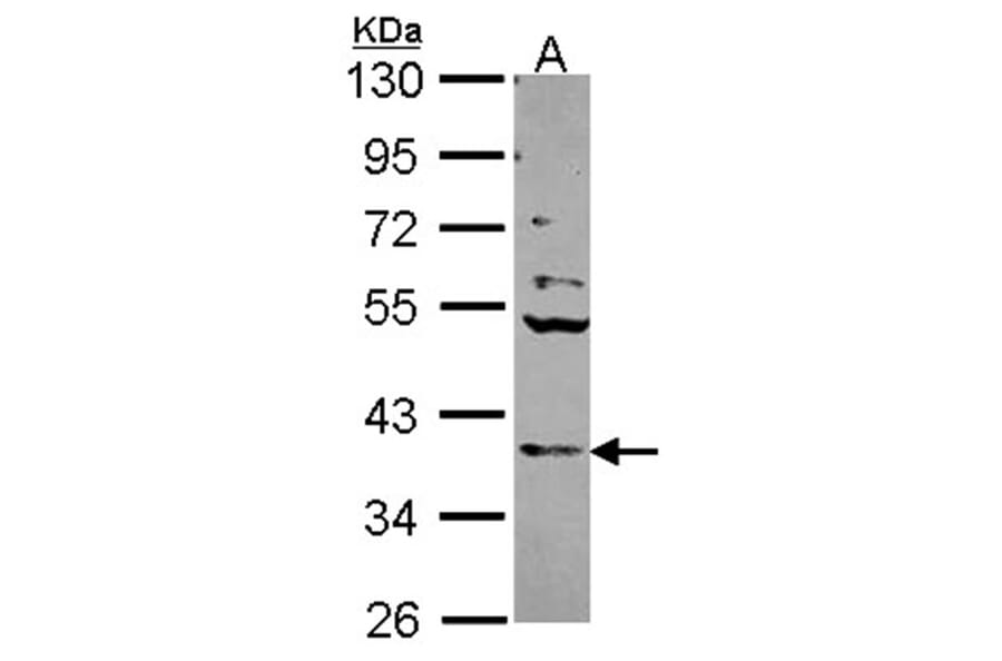 Cathepsin S antibody from Signalway Antibody (22690) - Antibodies.com