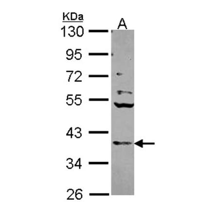 Cathepsin S antibody from Signalway Antibody (22690) - Antibodies.com