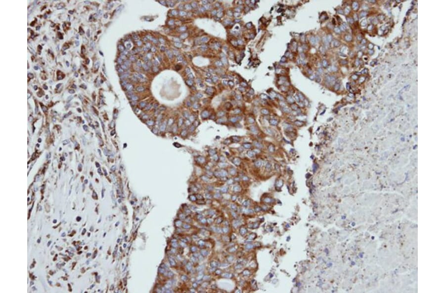 Immunohistochemistry - Cathepsin S antibody from Signalway Antibody (22690) - Antibodies.com