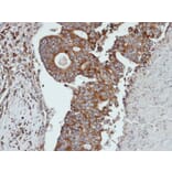 Immunohistochemistry - Cathepsin S antibody from Signalway Antibody (22690) - Antibodies.com