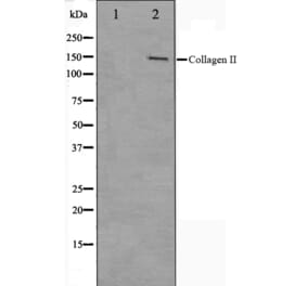 Western blot - Collagen II Antibody from Signalway Antibody (29157) - Antibodies.com