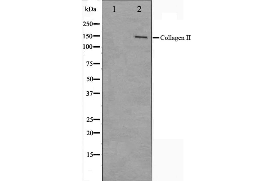 Western blot - Collagen II Antibody from Signalway Antibody (29157) - Antibodies.com