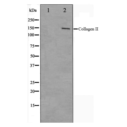 Western blot - Collagen II Antibody from Signalway Antibody (29157) - Antibodies.com