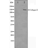 Western blot - Collagen II Antibody from Signalway Antibody (29157) - Antibodies.com