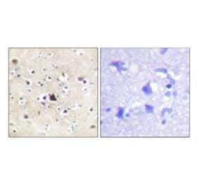 Immunohistochemistry - GR (Ab-226) Antibody from Signalway Antibody (33132) - Antibodies.com
