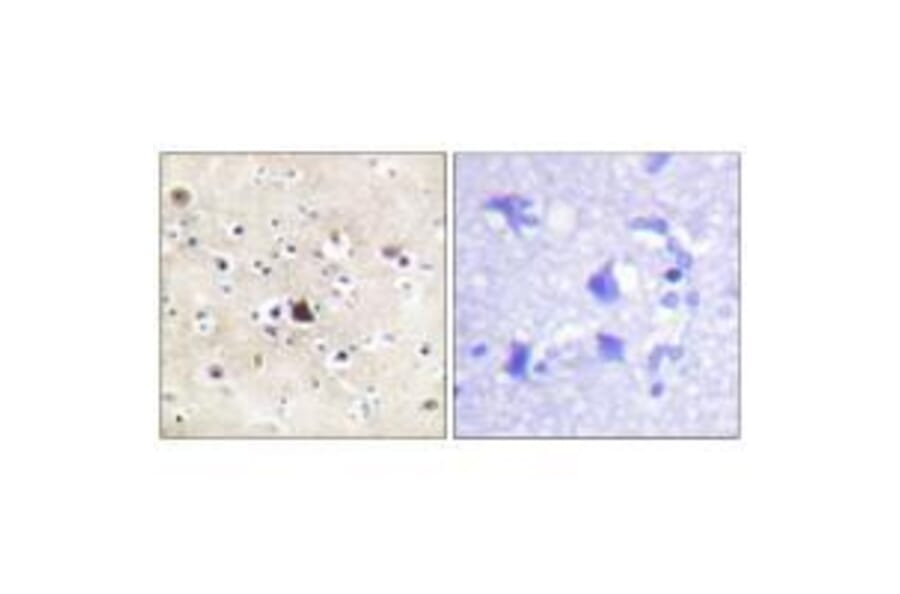 Immunohistochemistry - GR (Ab-226) Antibody from Signalway Antibody (33132) - Antibodies.com
