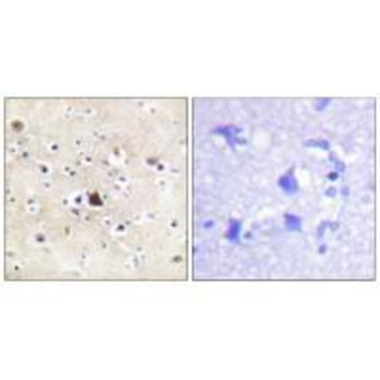 Immunohistochemistry - GR (Ab-226) Antibody from Signalway Antibody (33132) - Antibodies.com