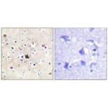 Immunohistochemistry - GR (Ab-226) Antibody from Signalway Antibody (33132) - Antibodies.com