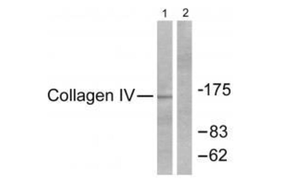 Western blot - Collagen IV Antibody from Signalway Antibody (33342) - Antibodies.com