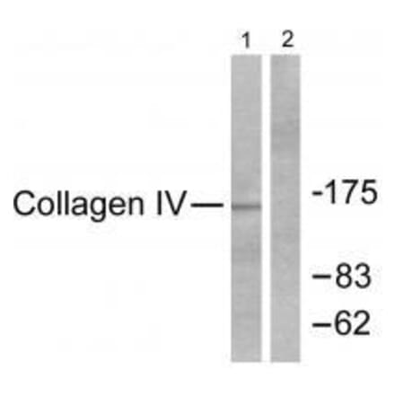 Western blot - Collagen IV Antibody from Signalway Antibody (33342) - Antibodies.com