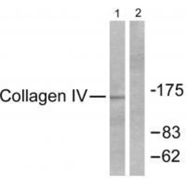 Western blot - Collagen IV Antibody from Signalway Antibody (33342) - Antibodies.com